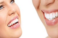 Gouttières dentaires : Dentiste à Paris 17ème 