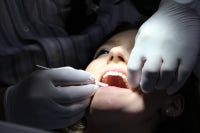 Les gouttières orthodontiques : Dentiste à Paris 17ème