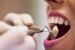 dentiste paris 17